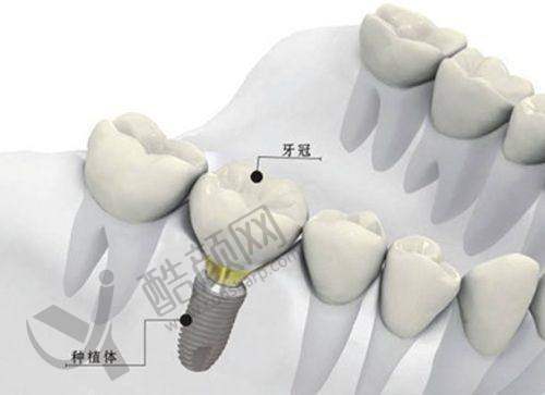 李懿个人资质