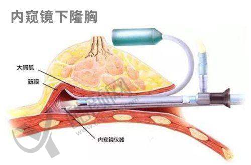 东莞爱思特黄刚怎么预约?