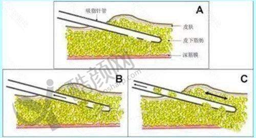 重庆军科整形VS华美整形:医生实力哪家强
