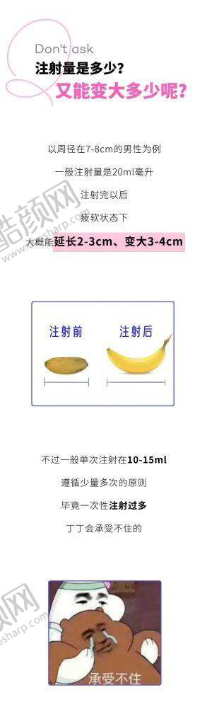 东莞爱思特魏鑫铭眼部综合整形实例