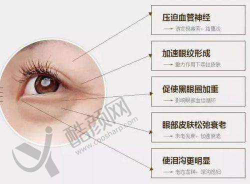 东莞爱思特黄刚项目价格表参考
