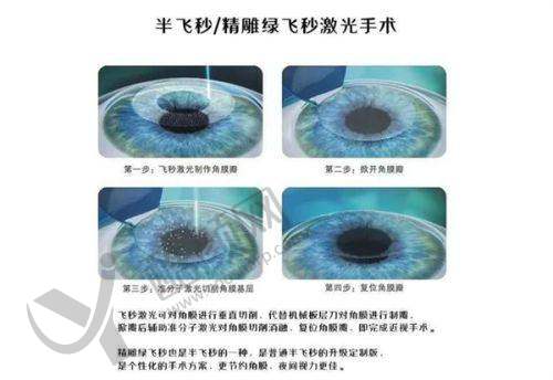 2025西安粉巷眼科医院地址与交通,特别便利