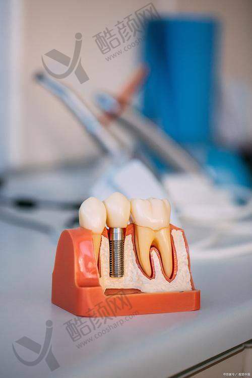 西安武海波医生项目价格表参考