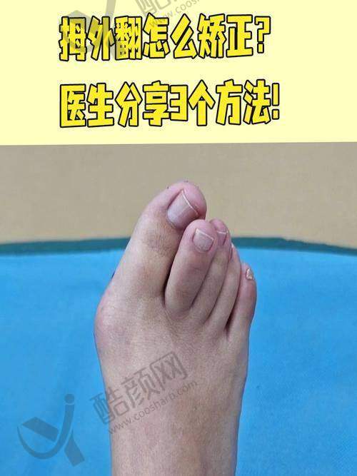 望京医院孙卫东医生：术后跟踪贴心服务