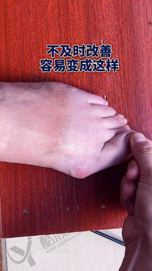 望京医院孙卫东医生：手术价格与性价比