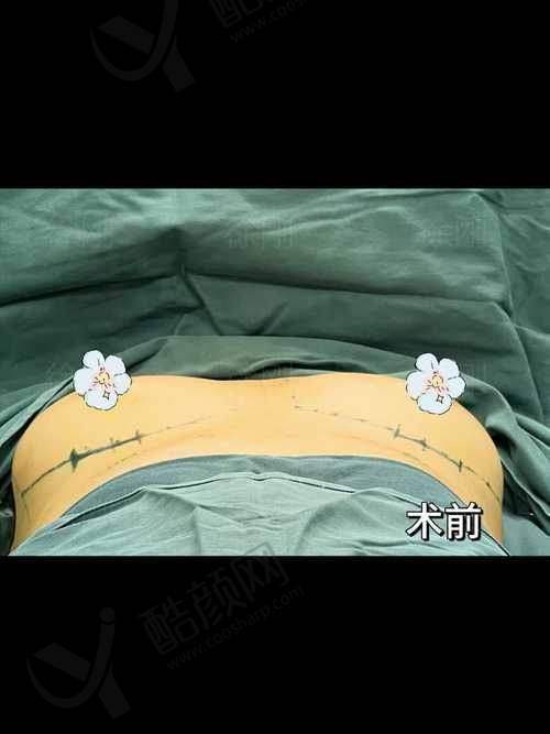 其他推荐医院及医生