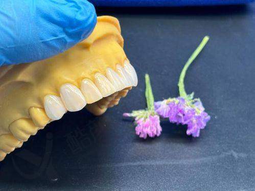 杭州瑞创口腔的优点