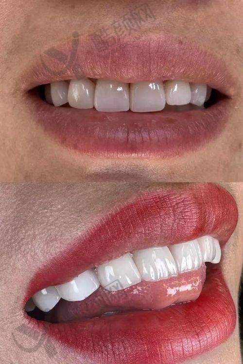 杭州瑞创口腔周裕翔院长介绍