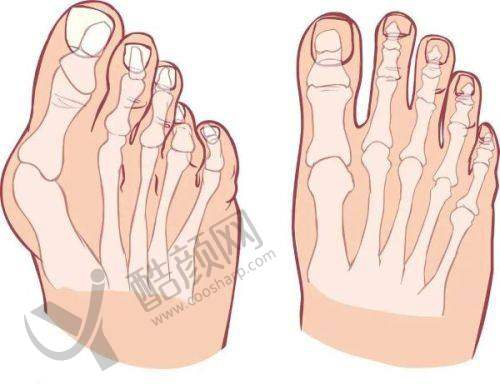 成都米兰柏羽整形医院开展的项目及技术特点