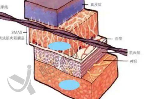杨庆华在哪家医院