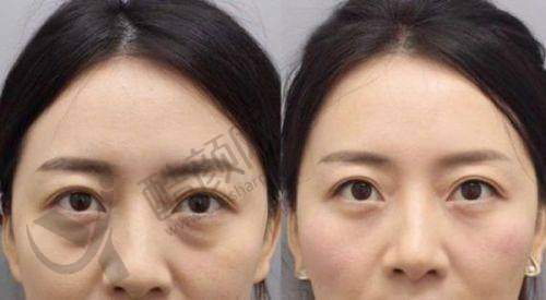 三、长春姬安娣医疗美容门诊部医生介绍: