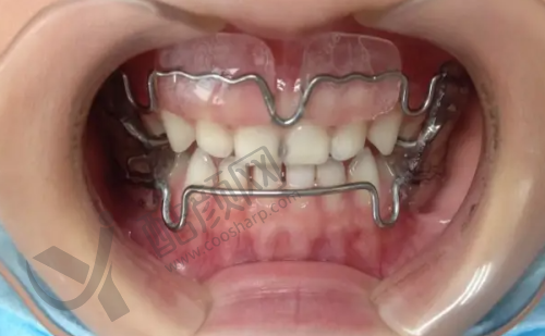 六、九江学院附属口腔医院可以走医疗保险吗?