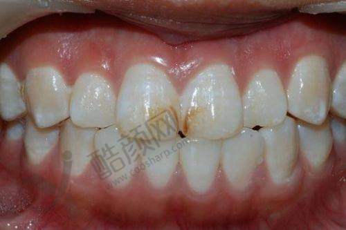 青浦中博口腔医院的收费价格