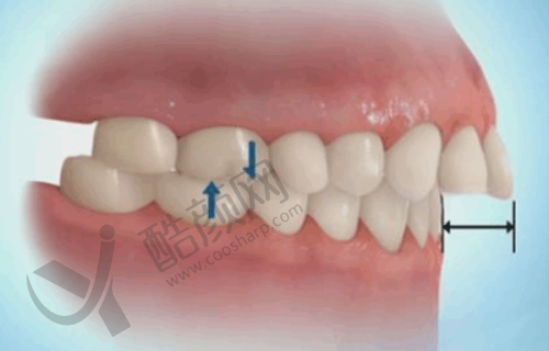 青岛可恩口腔医院王新木、刘阳：即刻种植的领跑者