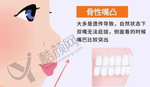 上海中博惠众口腔医院根管治疗的口碑评价