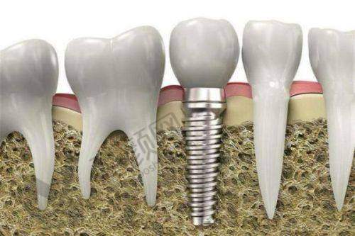 七、宁波鄞州德中口腔门诊部真实的患者评价如下：