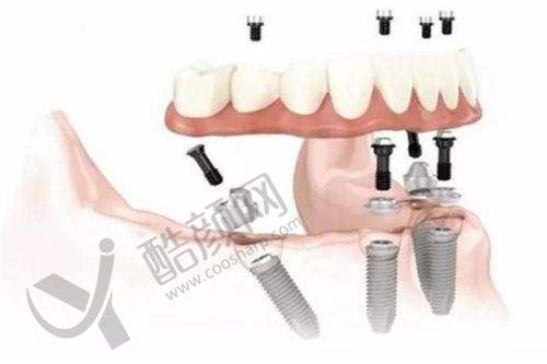 一、宁波鄞州德中口腔门诊部怎么样？