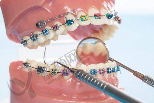 无锡新希尔口腔的其他优势