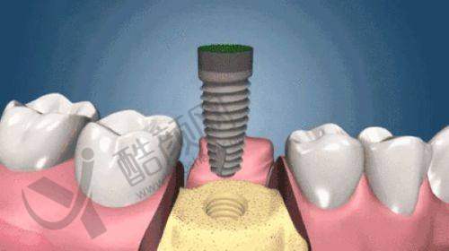 上海雅悦口腔共富路店位置及特色