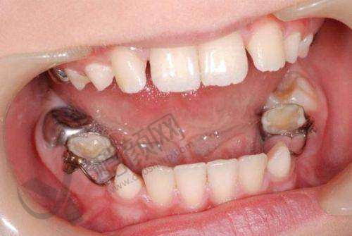 一、九江学院附属口腔医院怎么样?