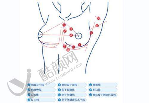 成都米兰柏羽整形医院的口碑与体验