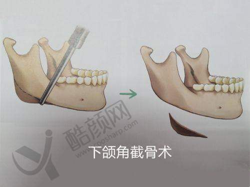 丁昆琨医生真实病例:成效显著有目共睹