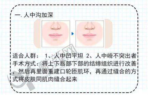 谭拯人中缩短真实实例:减龄成效显著