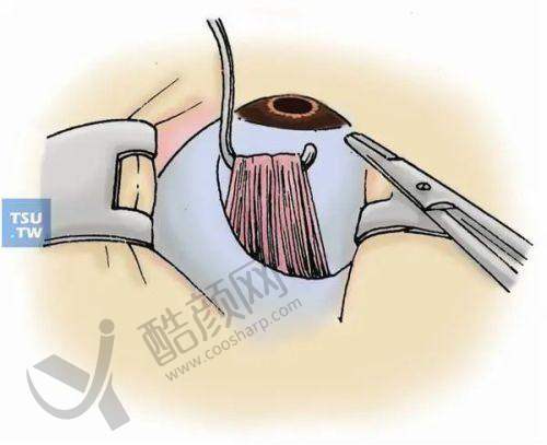 一、西安交通大学第一附属医院眼科怎么样?