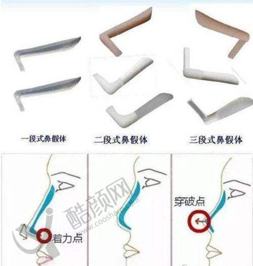 成都米兰柏羽整形医院价目表揭秘,涵盖多项目低价,资质优技术强体验好