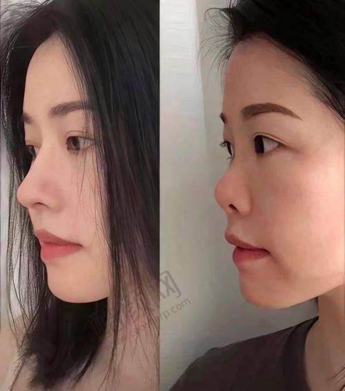 米兰柏羽陈倩的审美水平与手术风格