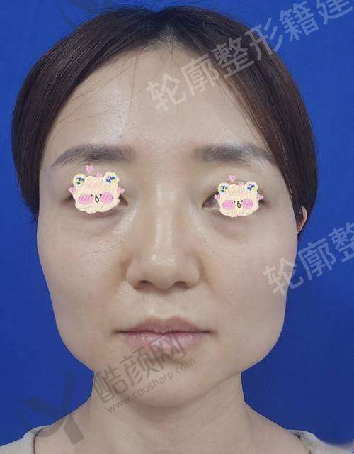 总结:放心选择,开启美丽新征程