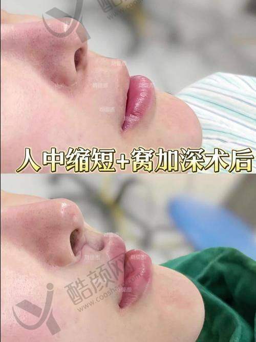 谭拯在哪家医院