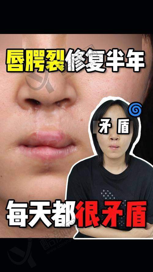 八大处宋涛:在哪家医院