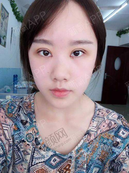 八大处整形医生宋彬在哪家医院