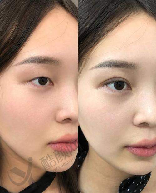 八大处整形医生宋彬怎么预约?