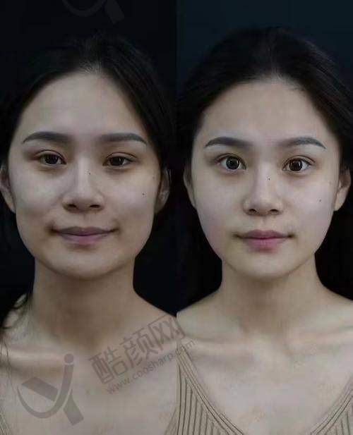 上海伊莱美医疗:智能注射仪实现精细填充