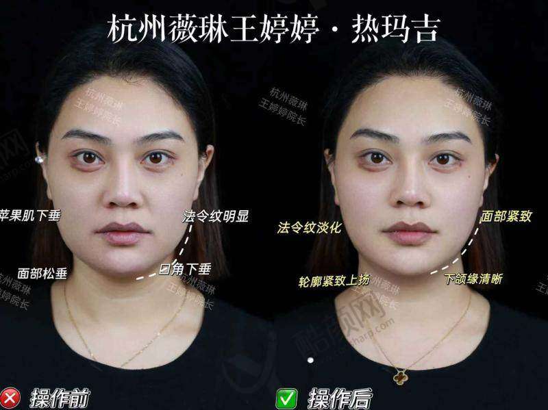 二、杭州薇琳医疗美容医院正规吗?来看看医院资质: