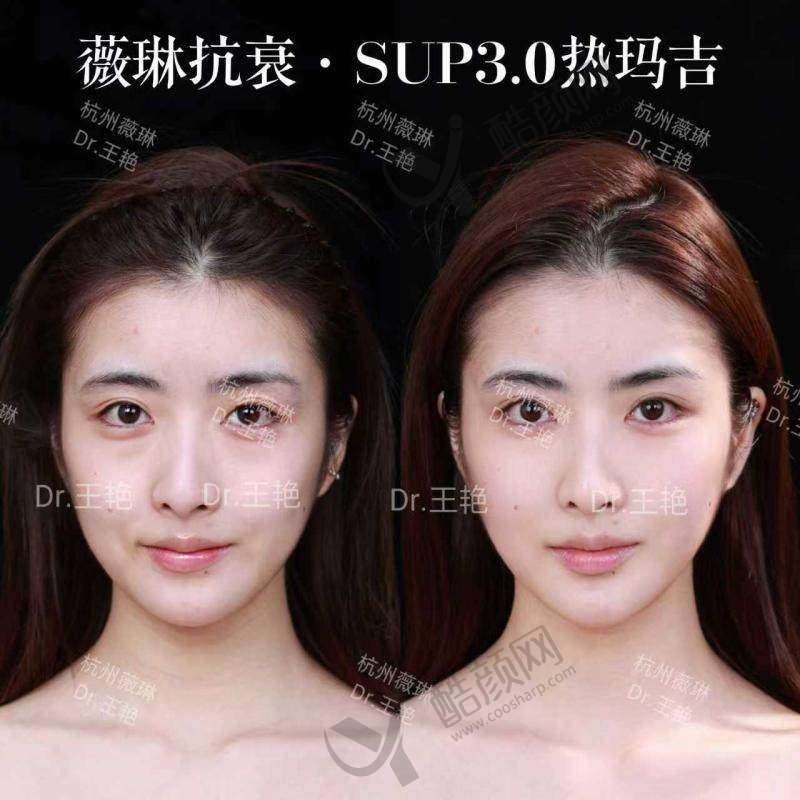 八、杭州薇琳医疗美容医院真实的顾客评价如下: