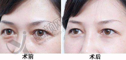 北京美莱张海明医生技术实力特点