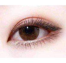 北京美莱张海明医生双眼皮修复成功实例