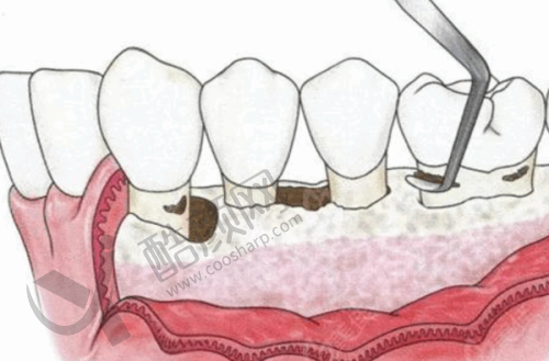 肖步挺在哪家医院