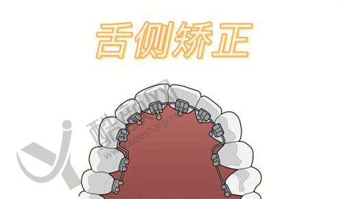 翟晓红口腔正畸实例
