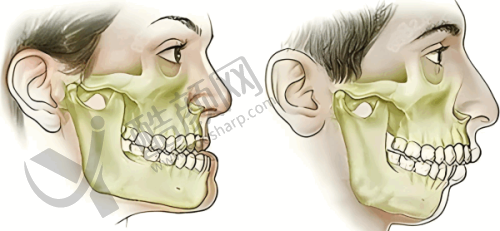 肖步挺种植牙水平怎么样可靠吗?