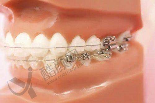 肖步挺项目价格表参考