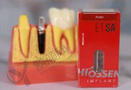 练小清种植牙修复水平怎么样可靠吗?