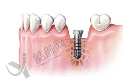 肖林喜项目价格表参考