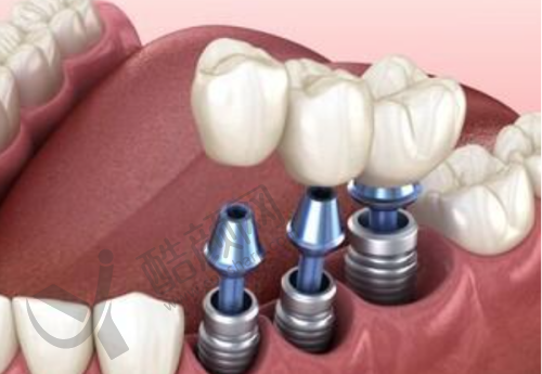 肖林喜怎么预约?