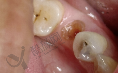 韩相国项目价格表参考