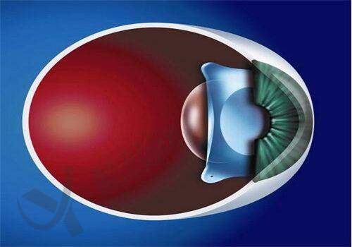 离石爱尔眼科医院的价格与口碑