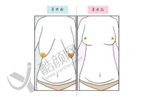 杨庆华医生在北京八大处的预约时间及挂号攻略